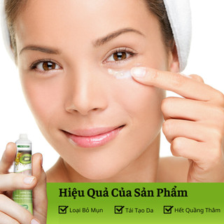 Kem Bôi Hết Sạch Mụn Thịt Quanh Mắt Và Toàn Bộ Cơ Thể  Bổ Sung Vitamin E Làm Trắng Sáng Da