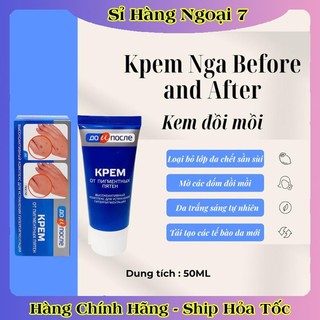 Kem đồi mồi Kpem Nga 50ml xóa mờ đồi mồi tay, tàn nhang dưỡng da tay trắng sáng mịn màng của Nga