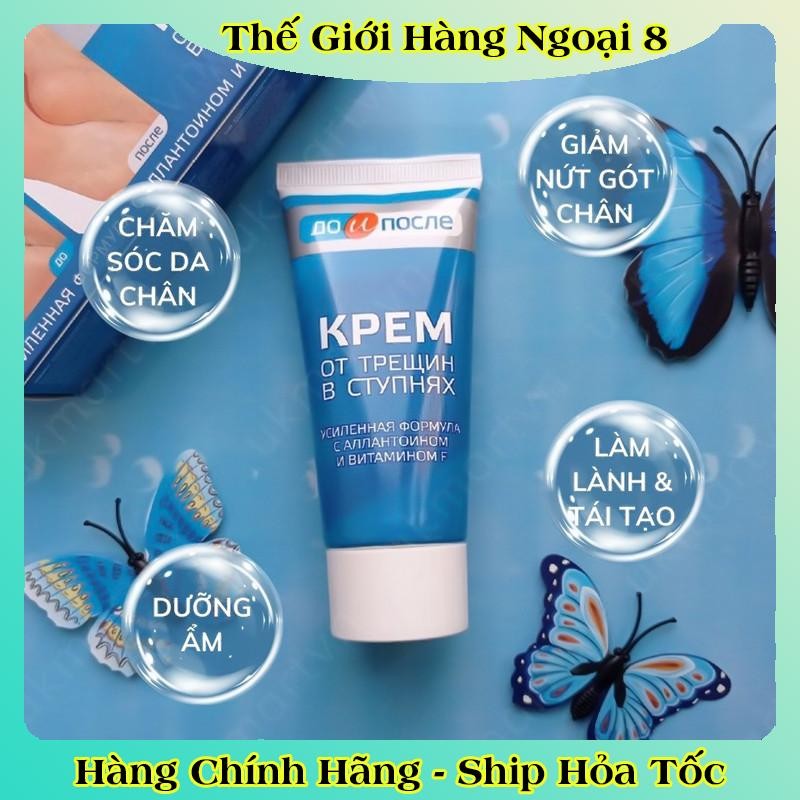 [ DATE MỚI] Kem Giảm Và Phục Hồi Nứt Nẻ Gót Chân Kpem 50ml của Nga