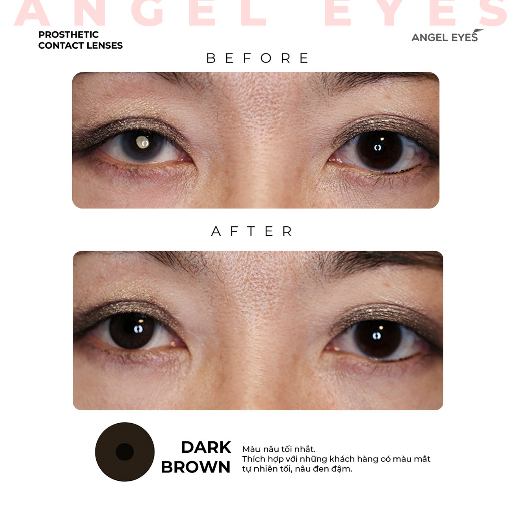 Lens Thẩm Mỹ Che Khuyết Điểm An.gel Ey.es, Kính Áp Tròng Cho Mắt Bị Đục Thủy Tinh Thể, Kéo Mây, Cườm
