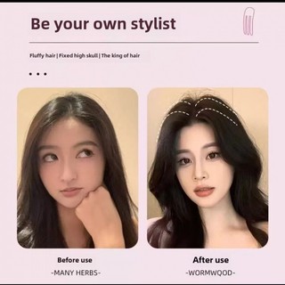 Bán chạy đầu lâu cao lông tơ tiện dụng đầu dụng cụ cố định kẹp tóc lông mịn bé trai và bé gái kẹp tóc Nhật Bản và Hàn Quốc Internet hot kẹp tóc gốc tóc cố định kẹp tóc lông mịn bé trai bé gái kẹp J