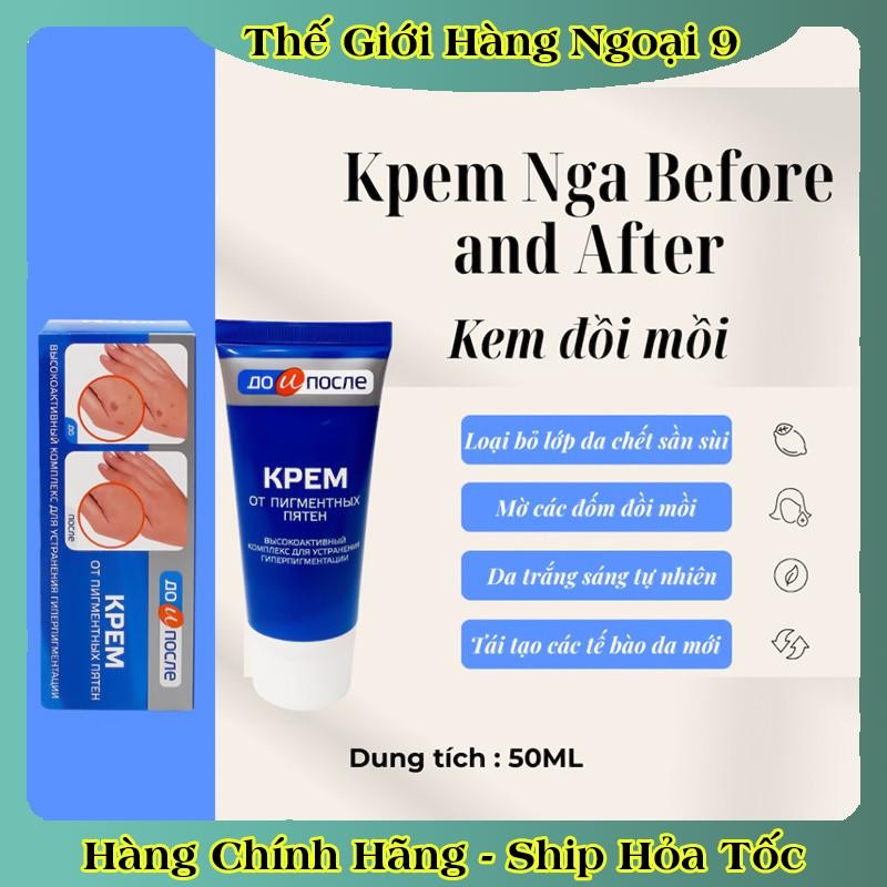 Kem đồi mồi Kpem Nga 50ml xóa mờ đồi mồi tay, tàn nhang dưỡng da tay trắng sáng mịn màng của Nga