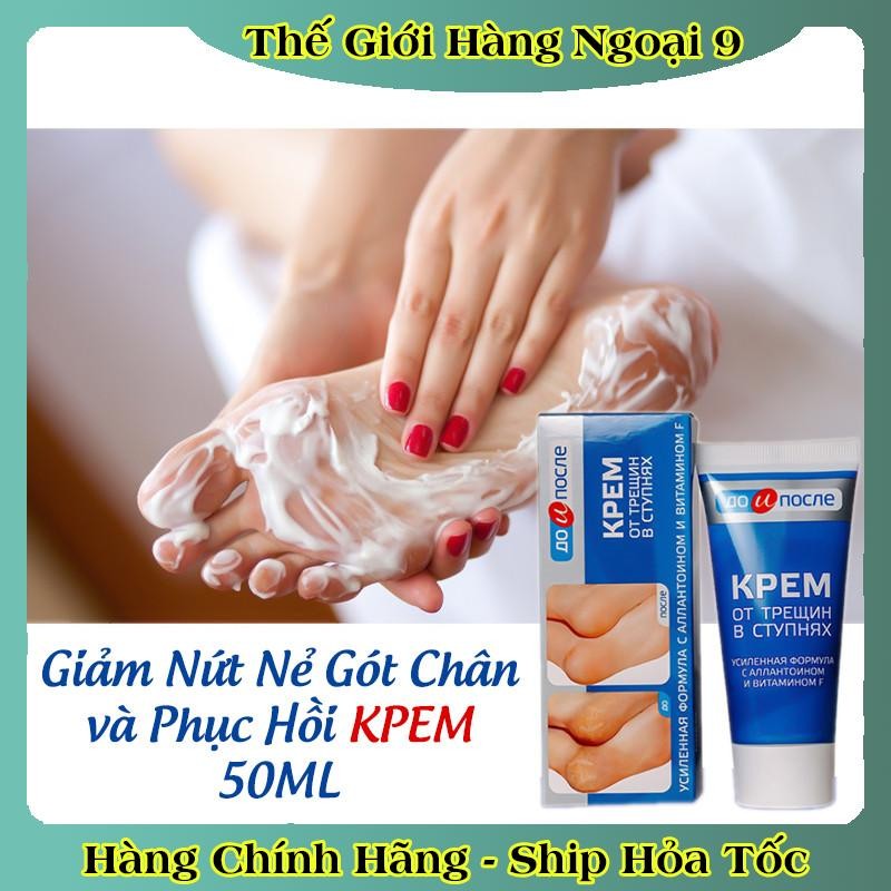 [ DATE MỚI] Kem Giảm Và Phục Hồi Nứt Nẻ Gót Chân Kpem 50ml của Nga