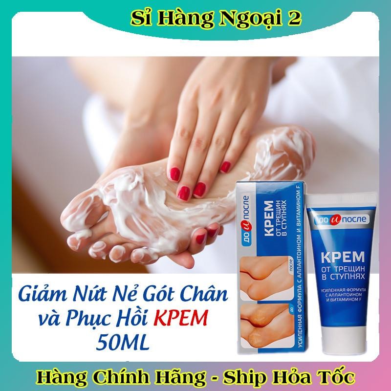 [ DATE MỚI] Kem Giảm Và Phục Hồi Nứt Nẻ Gót Chân Kpem 50ml của Nga