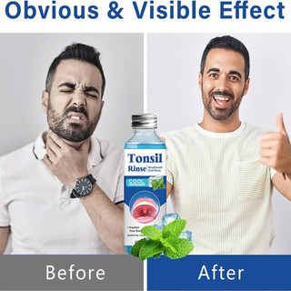 Tonsil Stone Rinse Natural Gentle Relief Anti-Bad Breath Travel-Friendly Dissolver