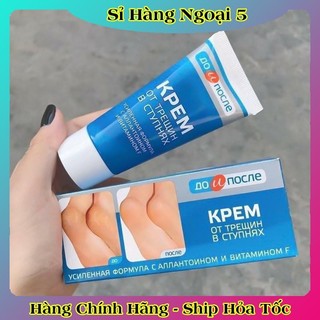 [ DATE MỚI] Kem Giảm Và Phục Hồi Nứt Nẻ Gót Chân Kpem 50ml của Nga