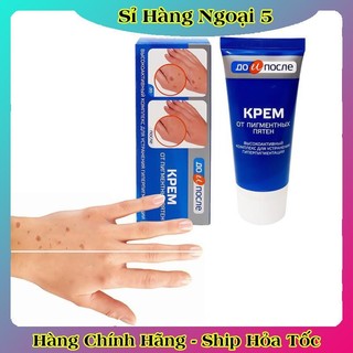 Kem đồi mồi Kpem Nga 50ml xóa mờ đồi mồi tay, tàn nhang dưỡng da tay trắng sáng mịn màng của Nga