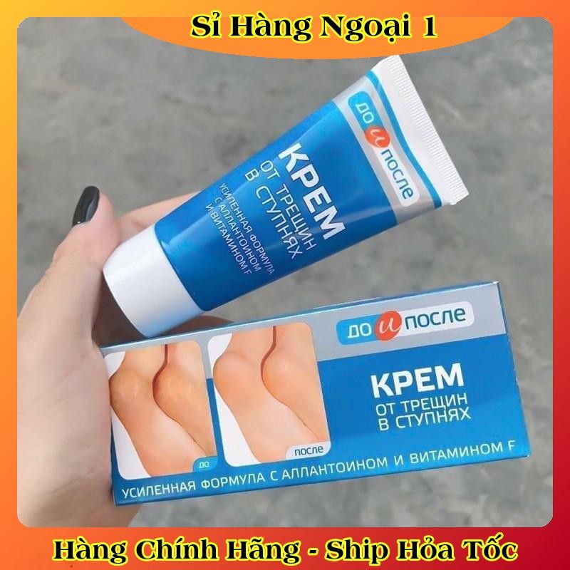 [ DATE MỚI] Kem Giảm Và Phục Hồi Nứt Nẻ Gót Chân Kpem 50ml của Nga