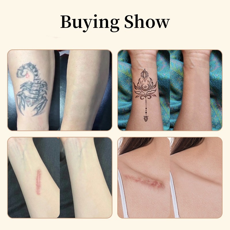 Đa Năng Chống Nước Hình Xăm Phim Siêu Mỏng Miếng Dán Hình Xăm Sẹo Che Băng Che Khuyết Điểm Hình Xăm Mụn