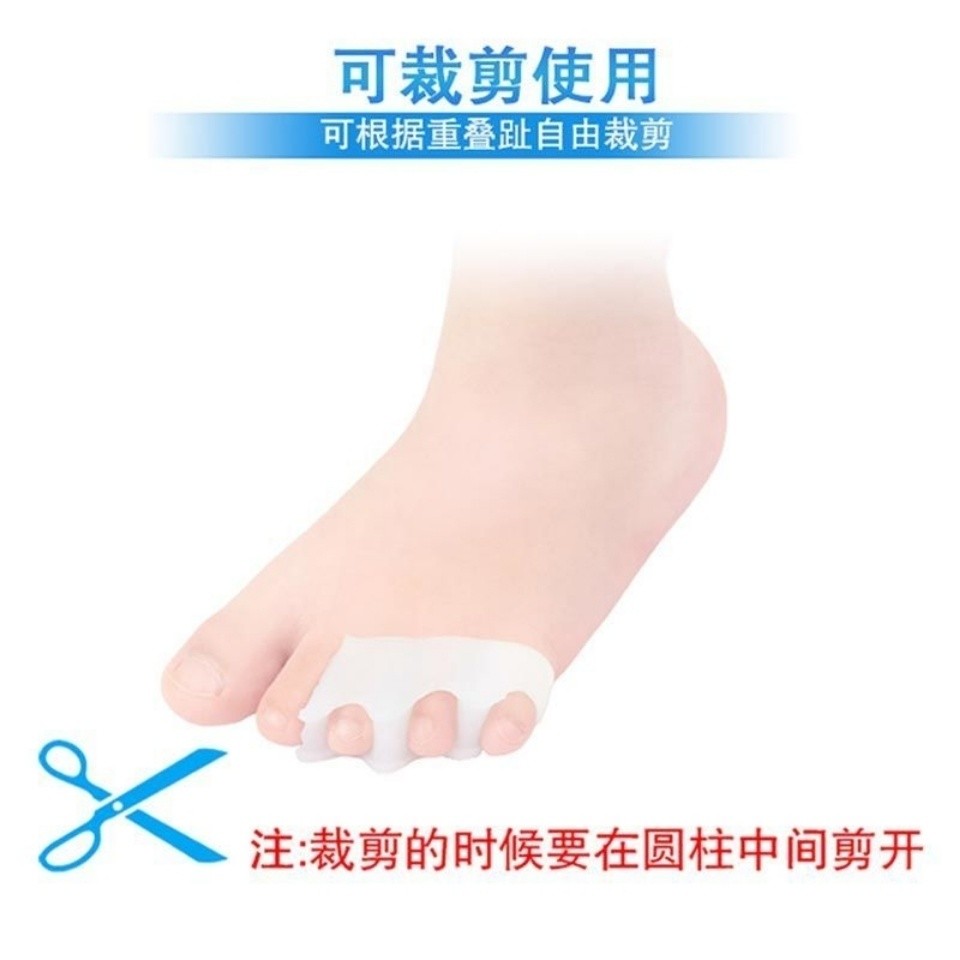 ✨✨Nền Tảng Bán Chạy Trẻ Em Mũi Corrector Bé Chồng Lên Ngón Chân Cái Valgus Chỉnh Sửa Ngón Chân Cho Bé Tách Ngón Chân 25.5.18
