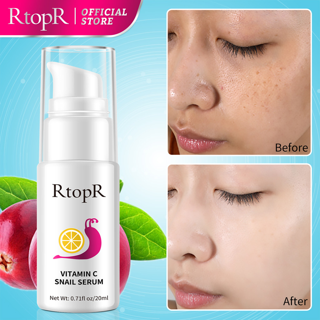 Ảnh Serum Dưỡng Da Trắng Da RtopR Chiết Xuất Ốc Sên/Vitamin C Chống Nếp Nhăn Săn Chắc Và Trẻ Hóa Làn Da Hiệu Quả Vitamin C Brightening 20ML 1