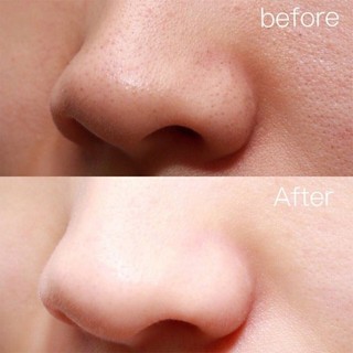 [Đến 3-5 ngày] 1 / 3 / 5 CÁI Dụng cụ làm sạch lỗ chân lông - Kim xỏ ngón mũi bằng thép không gỉ hai đầu - Kim loại loại bỏ mụn đầu đen mụn - Dụng cụ làm sạch sâu - Dụng cụ chăm sóc da mặt