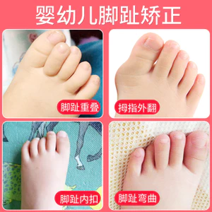 ✨✨Nền Tảng Bán Chạy Bé Ngón Chân Corrector Trẻ Em Chuyên Dụng Cho Bé Chồng Lên Ngón Chân Bộ Chia Chỉnh Dụng Cụ Tiện Dụng Ngón Tay Cái Valgus Trẻ Em Tập Đi 25.5.18