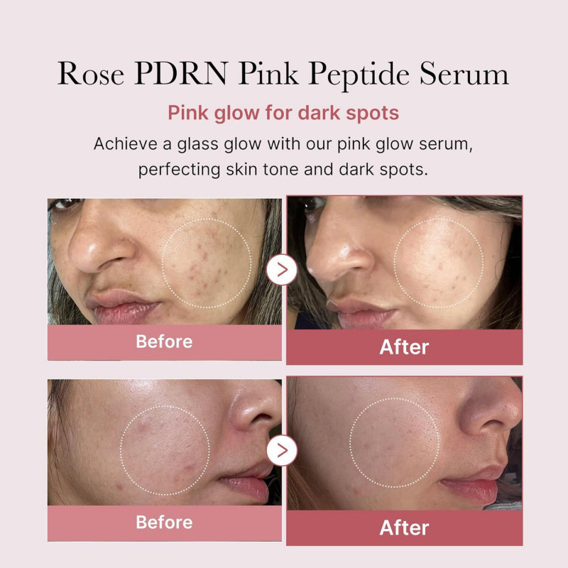 Serum peptide hồng Medicube PDRN 30ml, làm trắng da và loại bỏ vết thâm, tinh chất mặt KGGF