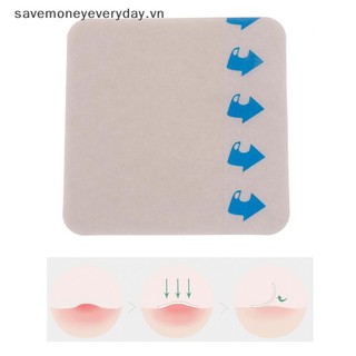 [savemoneyeveryday] Miếng dán vết thương dạng keo dán vết thương vô trùng [vn]