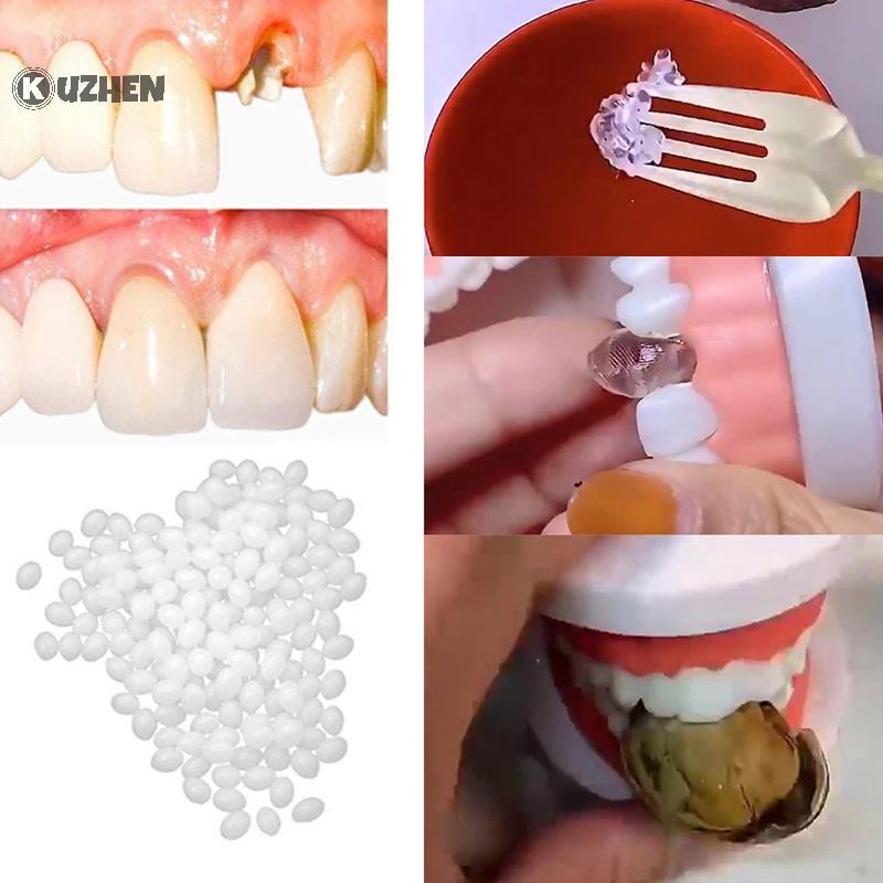 KUZHEN Bộ dụng cụ răng tạm thời 10g/15g/20g: keo dán, làm trắng, che khoảng cách, dụng cụ làm đẹp HOT