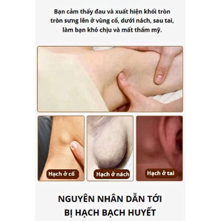 Kem Tan Hạch Bạch Huyết Nhật Bản - Hỗ Trợ Teo Hạch, Lưu Thông Mạch Máu, Giảm Bướu Cổ Hiệu Quả