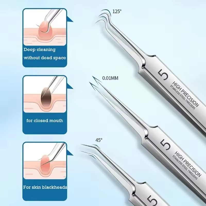 1 / 2 Salon Chăm Sóc Sắc Đẹp Đức Ultra - Fine No. Dụng cụ làm sạch nhíp mụn đầu đen 5 Cell