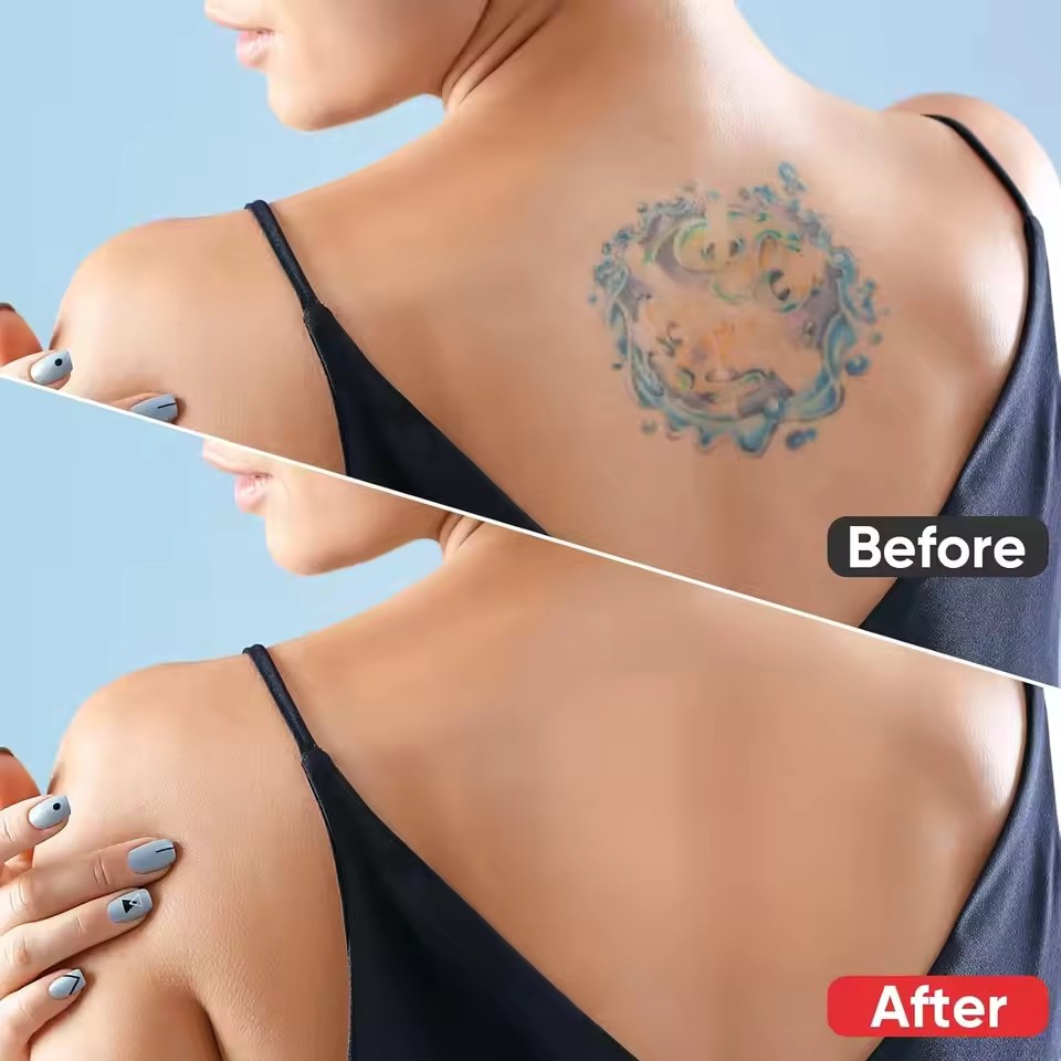 Đa Năng Chống Nước Hình Xăm Phim Siêu Mỏng Miếng Dán Hình Xăm Sẹo Che Băng Che Khuyết Điểm Hình Xăm Mụn