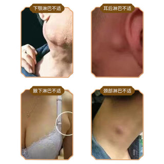 Kem Tan Hạch Bạch Huyết Nhật Bản - Hỗ Trợ Teo Hạch, Lưu Thông Mạch Máu, Giảm Bướu Cổ Hiệu Quả
