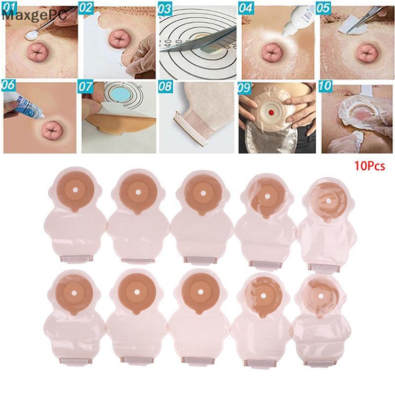 Cod 10pcs trẻ em dính đóng cửa một mảnh thoát nước colostomy Túi stoma chăm sóc túi mới