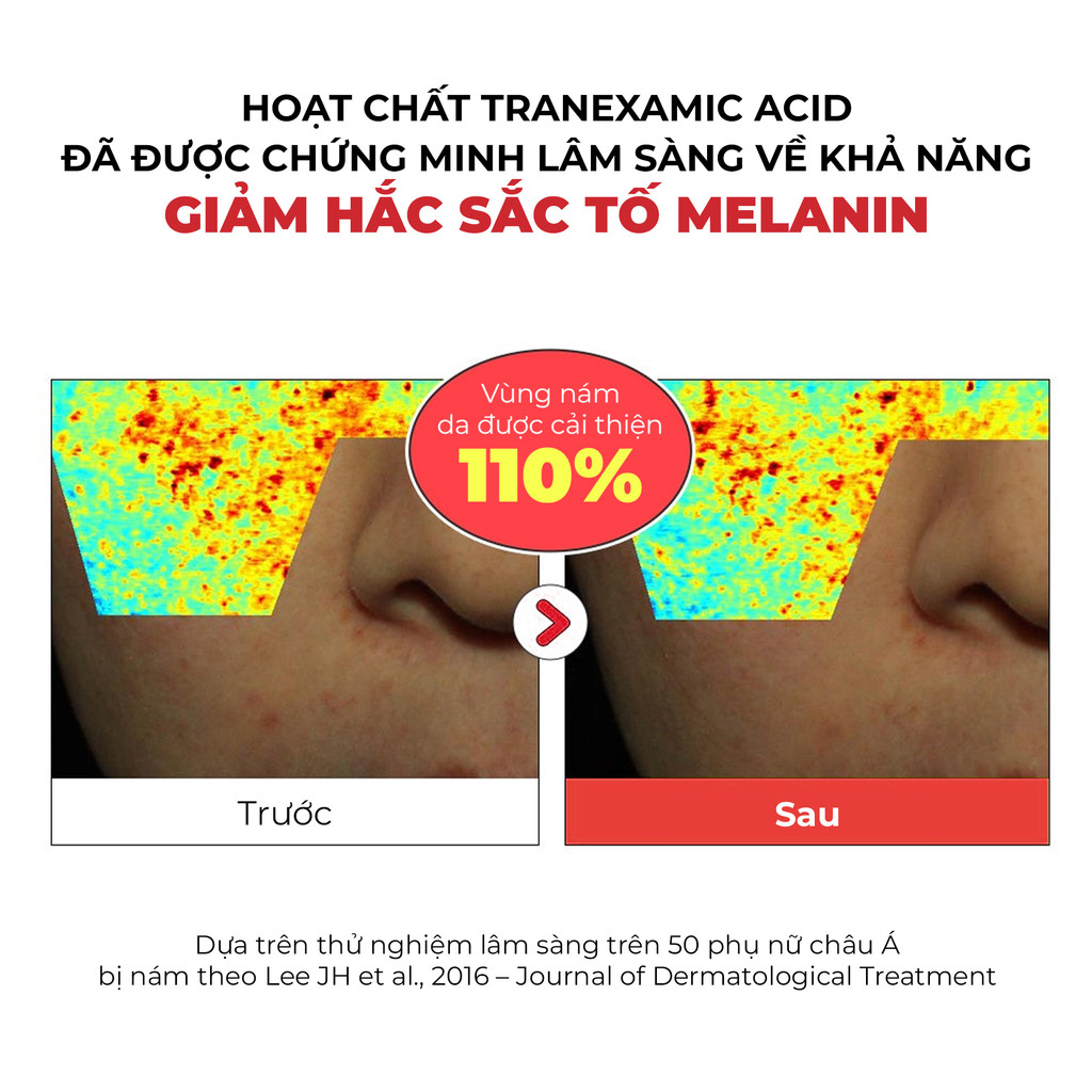 Serum Dưỡng Trắng Mờ Thâm Nám Tia’m Tranexin Nia Vita Serum 40ml | BigBuy360 - bigbuy360.vn