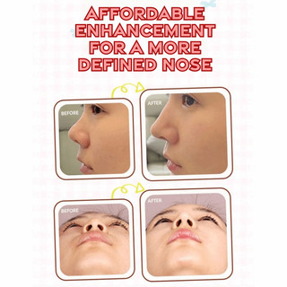 LILYES 20/50 Miếng dán định hình mũi, cầu nâng lên tinh tế, hỗ trợ nâng mũi thoáng khí, công cụ làm đẹp hoạt hình