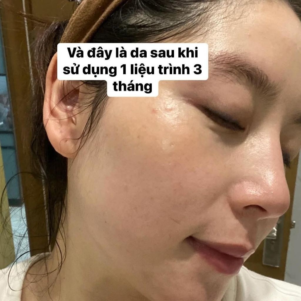 Kem Nám Mờ Thâm Konigin Mờ Thâm, Dưỡng Trắng, Cấp Ẩm & Phục Hồi Da Bộ 4 Món