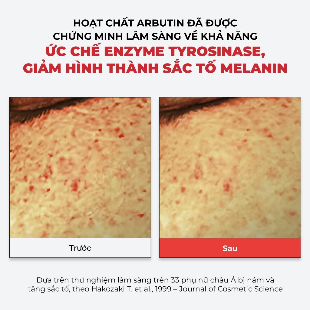 Serum Dưỡng Trắng Mờ Thâm Nám Tia’m Tranexin Nia Vita Serum 40ml | BigBuy360 - bigbuy360.vn
