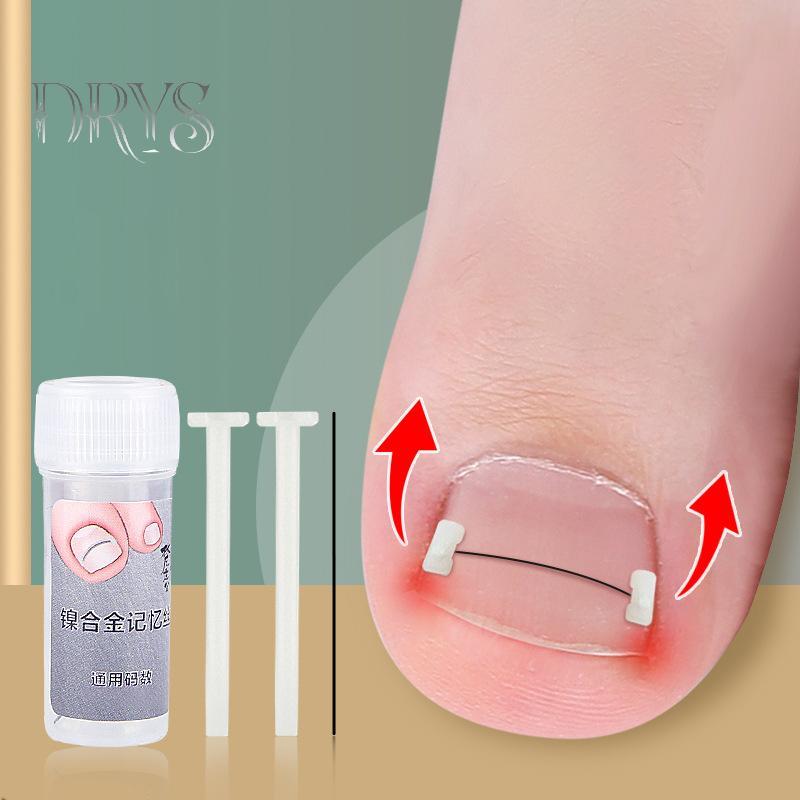 Dụng cụ chỉnh sửa móng mọc ngược, phục hồi móng, chăm sóc bàn chân chuyên nghiệp