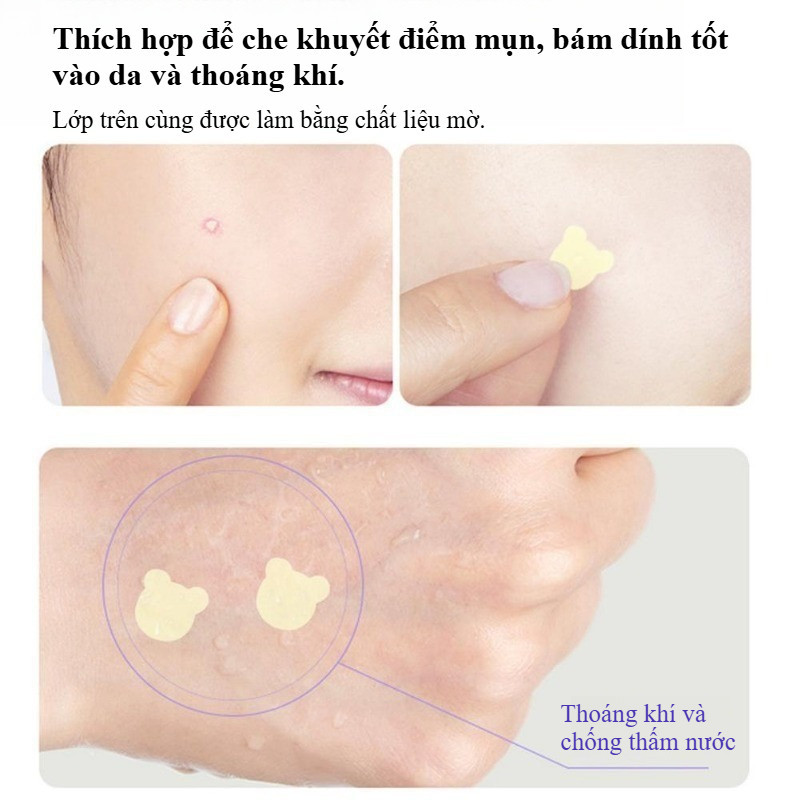Miếng Dán Mụn Cho Mặt,108/200/420pcs,Cải Thiện Mụn Trứng Cá Và Bảo Vệ Da Tốt Hơn,phù Hợp Với Tất Cả Các Loại Da