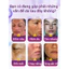 Loại bỏ sự bình tĩnh sắc tố 99,99%, Tẩy vết thâm, Bút Laser tàn nhang, Loại bỏ tàn nhang, Chăm sóc tính toán sắc tố, Loại bỏ vết thâm Độ yên tĩnh sắc tố
