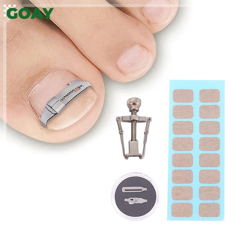 GOAY Dụng cụ chỉnh sửa móng mọc ngược, phục hồi móng, chăm sóc bàn chân chuyên nghiệp VN