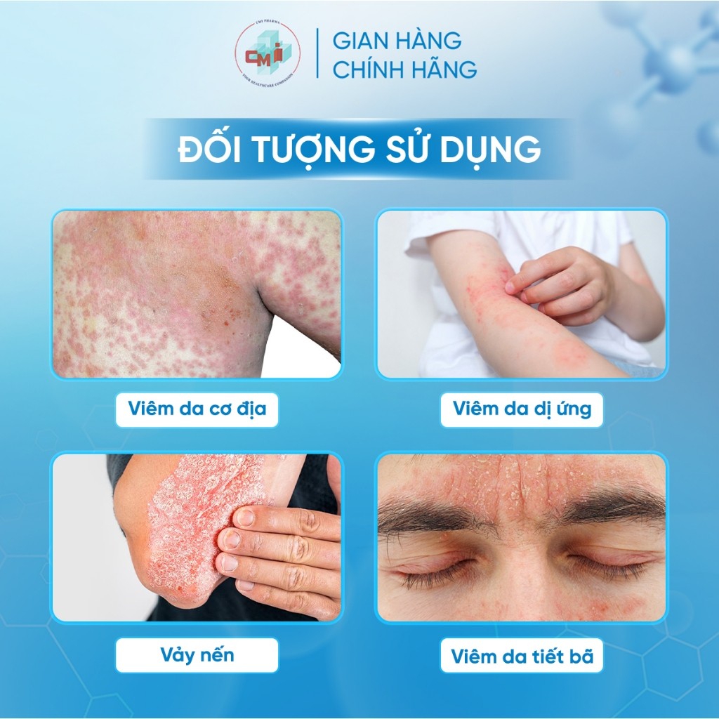 Xịt Blue Cap Spray Hỗ Trợ Vảy Nến, Viêm Da Cơ Địa, Viêm Da Dị Ứng, Viêm Da Tiết Bã, 50ML
