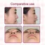 EBINLANDS 10 Cái / hộp Điêu khắc mũi, Nhãn dán định hình mũi có thể điều chỉnh hoạt hình, Dải nâng mũi có thể tái sử dụng để định hình lại mũi Dụng cụ mỹ phẩm định hình lại đường viền