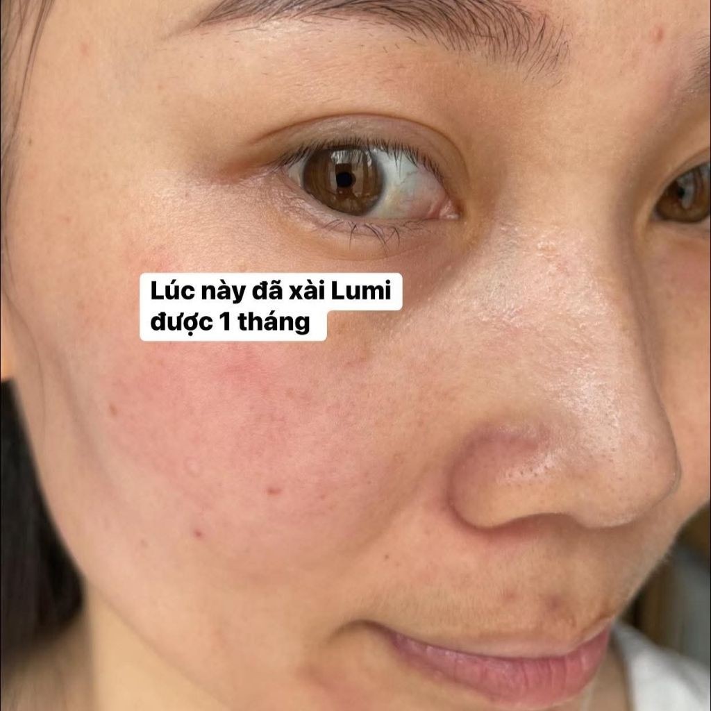 Kem Ngày Lumi Arbutin Dưỡng Trắng Da Mờ Thâm Nám, Cấp Ẩm Sâu, Ngừa Mụn, Làm Nền Nhẹ