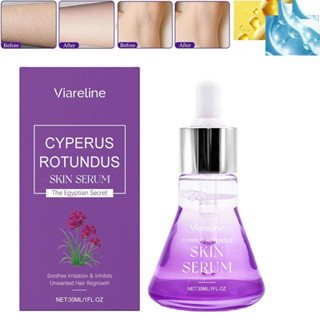 Viareline Cyperus Rotundus Skin Serum Natural Organic Cyperus Rotundus Oil 30ML