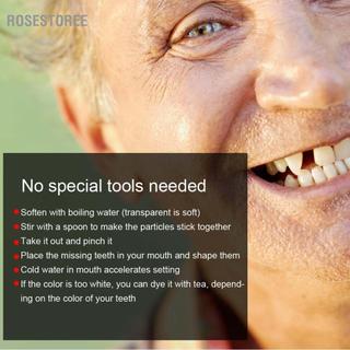 rosestoree Hạt sửa chữa răng tạm thời Thẩm mỹ răng gãy có răng [10g]