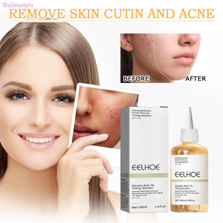 Nước Hoa Hồng 100ml  Chăm Sóc Da, Loại  Mụn Trứng Cá Nâng Cơ Săn Chắc Giảm Nếp Nhăn Làm Trắng Dưỡng Ẩm Da Kiểm Soát Dầu
