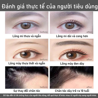 Serum dưỡng mi Mascara Dưỡng mi dài 7ml Serum tăng trưởng lông mi Kích thích mọc lông mi duy trì làn mi chắc khỏe