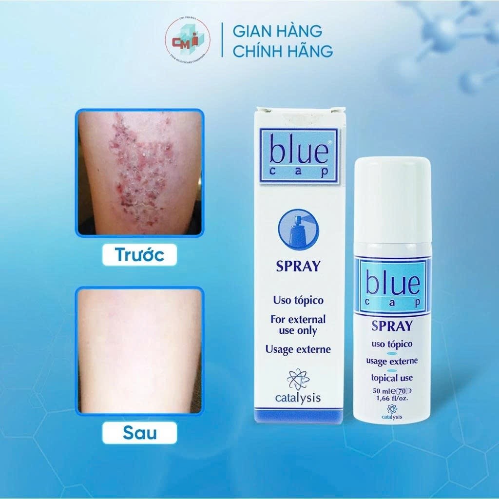 Blue Cap Spray 50ml dạng xịt hỗ trợ giảm vảy nến, viêm da cơ địa, viêm da tiết bã, viêm da dị ứng
