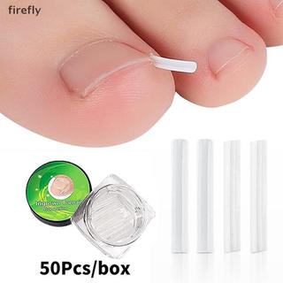 [Firefly] 50 Cái Dụng cụ chỉnh sửa móng chân mọc ngược Điều trị móng chân Chân mọc ngược Miếng dán đàn hồi Miếng dán thẳng Kẹp nẹp Dụng cụ làm móng chân [VN]