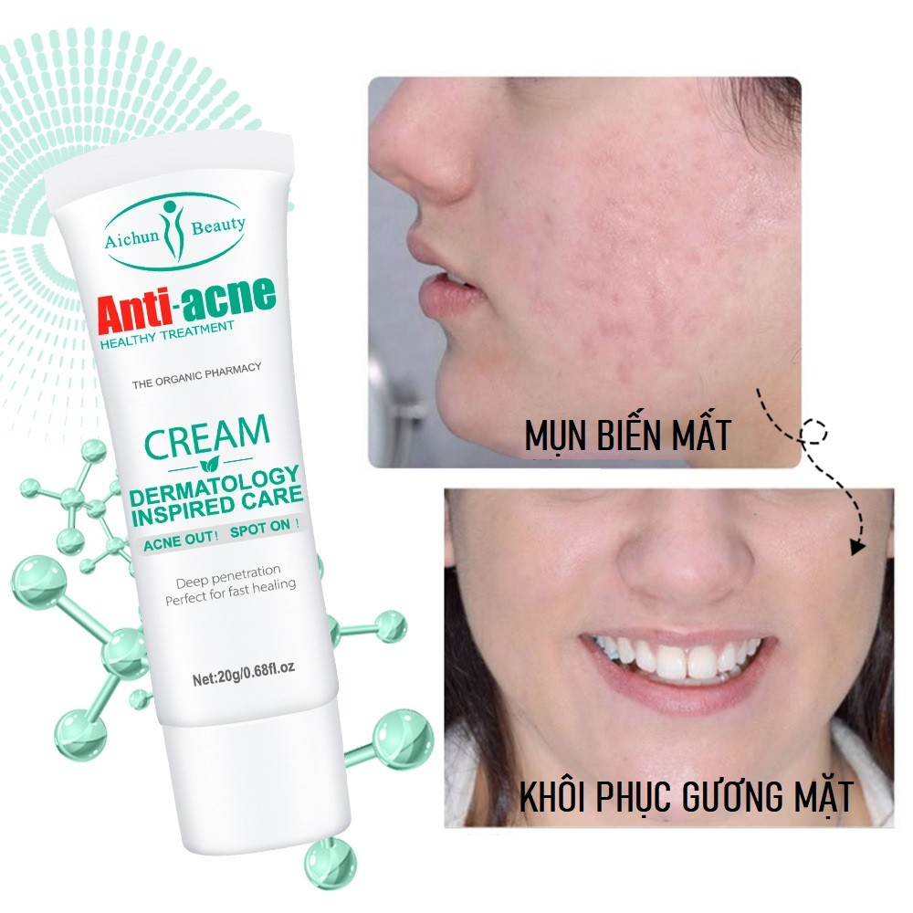 Kem Chuyên Biệt Giảm Thâm Mụn Chuyên Sâu Anti-Acne Sạch Mụn, Mờ Thâm 20gm
