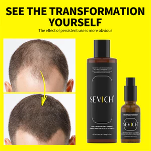 Dầu Gội Chống Rụng Tóc SEVICH Chiết Xuất Thực Vật Dầu Gội Gừng Tăng Trưởng Tóc 200ml