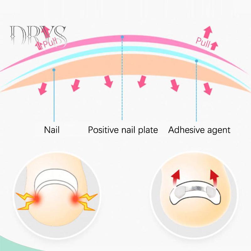 Dụng cụ chỉnh sửa móng mọc ngược, phục hồi móng, chăm sóc bàn chân chuyên nghiệp