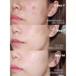 DMT medicotem illuminating white cell ampoule serum
