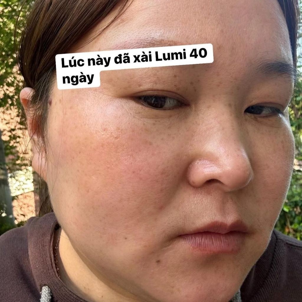 Kem Ngày Lumi Arbutin Dưỡng Trắng Da Mờ Thâm Nám, Cấp Ẩm Sâu, Ngừa Mụn, Làm Nền Nhẹ