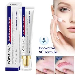 Kem Chăm Sóc Da KORMESIC Kem xóa sẹo – Hỗ Trợ Làm Mờ Vết Thương Trên Da, Cấp Ẩm & Nuôi Dưỡng Làn Da Khỏe Mạnh 30ml