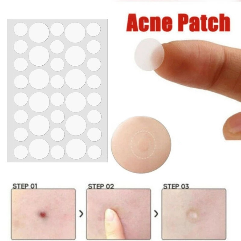 Shine🍊Salicylic Acid 36 Miếng Dán Hạt Mụn Miếng Dán la Vô Hình Mụn Loại Bỏ Dấu Vết Mụn Miếng Dán