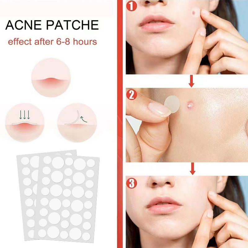 Shine🍊Salicylic Acid 36 Miếng Dán Hạt Mụn Miếng Dán la Vô Hình Mụn Loại Bỏ Dấu Vết Mụn Miếng Dán